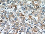 TMEM25 Antibody in Immunohistochemistry (Paraffin) (IHC (P))