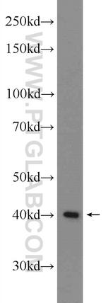 TMEM25 Antibody in Western Blot (WB)