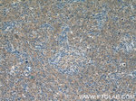GPATCH2 Antibody in Immunohistochemistry (Paraffin) (IHC (P))