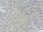 GPATCH2 Antibody in Immunohistochemistry (Paraffin) (IHC (P))