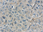 GPATCH2 Antibody in Immunohistochemistry (Paraffin) (IHC (P))