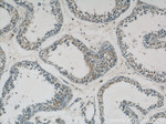 GPATCH2 Antibody in Immunohistochemistry (Paraffin) (IHC (P))