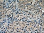 GPATCH2 Antibody in Immunohistochemistry (Paraffin) (IHC (P))