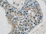 GPATCH2 Antibody in Immunohistochemistry (Paraffin) (IHC (P))