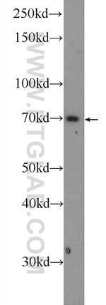 GPATCH2 Antibody in Western Blot (WB)