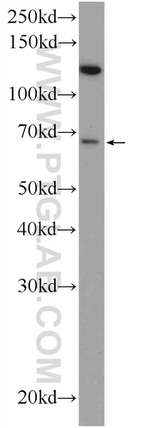GPATCH2 Antibody in Western Blot (WB)