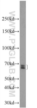 GPATCH2 Antibody in Western Blot (WB)