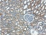 RBM46 Antibody in Immunohistochemistry (Paraffin) (IHC (P))