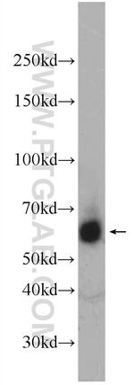 RBM46 Antibody in Western Blot (WB)