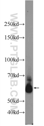 RBM46 Antibody in Western Blot (WB)