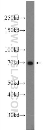 TRIM67 Antibody in Western Blot (WB)