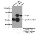 CCDC65 Antibody in Immunoprecipitation (IP)