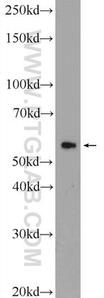 CCDC65 Antibody in Western Blot (WB)