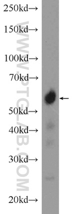 CCDC65 Antibody in Western Blot (WB)