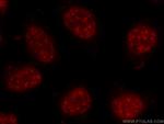 C17orf85 Antibody in Immunocytochemistry (ICC/IF)