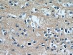 MLK4 Antibody in Immunohistochemistry (Paraffin) (IHC (P))