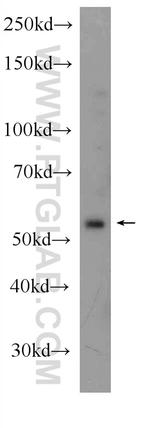 MLK4 Antibody in Western Blot (WB)