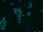 GPATCH4 Antibody in Immunocytochemistry (ICC/IF)