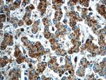 GPATCH4 Antibody in Immunohistochemistry (Paraffin) (IHC (P))