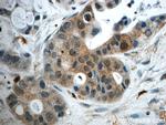 GPATCH4 Antibody in Immunohistochemistry (Paraffin) (IHC (P))