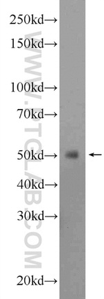 GPATCH4 Antibody in Western Blot (WB)