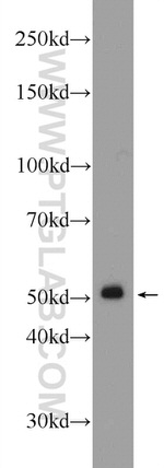 GPATCH4 Antibody in Western Blot (WB)