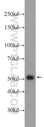 GPATCH4 Antibody in Western Blot (WB)