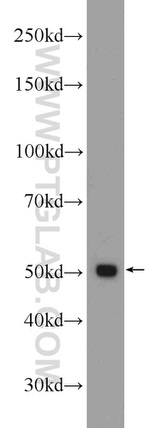 GPATCH4 Antibody in Western Blot (WB)
