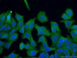 TRIM16 Antibody in Immunocytochemistry (ICC/IF)