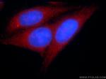 KTELC1 Antibody in Immunocytochemistry (ICC/IF)