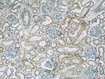 DMXL2 Antibody in Immunohistochemistry (Paraffin) (IHC (P))