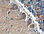 DMXL2 Antibody in Immunohistochemistry (Paraffin) (IHC (P))