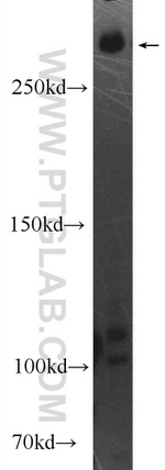 DMXL2 Antibody in Western Blot (WB)