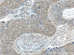 CWC25 Antibody in Immunohistochemistry (Paraffin) (IHC (P))