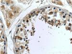 CWC25 Antibody in Immunohistochemistry (Paraffin) (IHC (P))