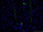 CHAT Antibody in Immunohistochemistry (PFA fixed) (IHC (PFA))