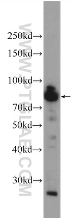 FAM48A Antibody in Western Blot (WB)