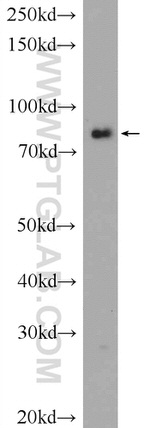 FAM48A Antibody in Western Blot (WB)