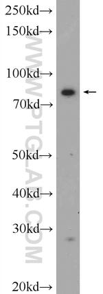 FAM48A Antibody in Western Blot (WB)