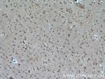 TALPID3 Antibody in Immunohistochemistry (Paraffin) (IHC (P))