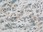 FAM168B Antibody in Immunohistochemistry (Paraffin) (IHC (P))