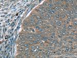 FAM168B Antibody in Immunohistochemistry (Paraffin) (IHC (P))