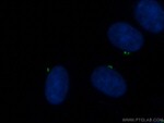 CEP135 Antibody in Immunocytochemistry (ICC/IF)