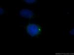 CEP135 Antibody in Immunocytochemistry (ICC/IF)
