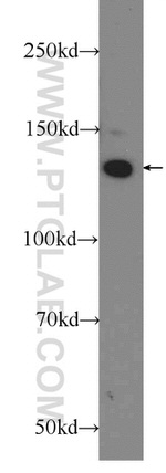 CEP135 Antibody in Western Blot (WB)