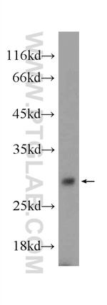 TEX38 Antibody in Western Blot (WB)