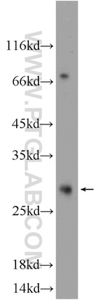 TEX38 Antibody in Western Blot (WB)