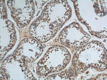 WDR7 Antibody in Immunohistochemistry (Paraffin) (IHC (P))