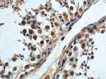 WDR7 Antibody in Immunohistochemistry (Paraffin) (IHC (P))