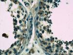 WDR7 Antibody in Immunohistochemistry (Paraffin) (IHC (P))